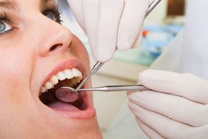 Tooth Infection San Ramon