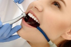 Determining if you have a cavity