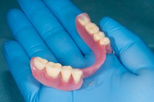 Partial Dentures: Pros & Cons Of Flipper Teeth