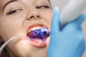 Person at the dentist's office having a dental bonding procedure performed.